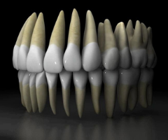 Slider image (3) Easy Dental